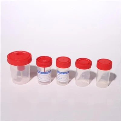 Wadah Spesimen Kotoran Urine